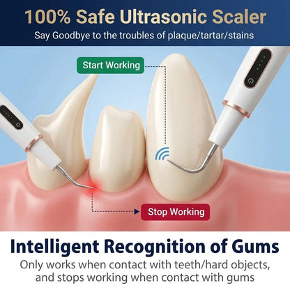 Gum-safe sensor diagram showing ultrasonic pet dental scaler stopping at soft tissue